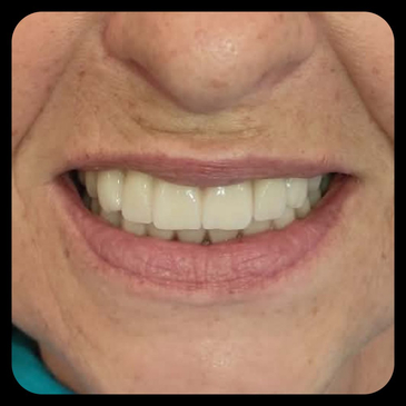 Slider image (8) Dr. Aleksandar Kovacevic - Dental Clinic in Croatia